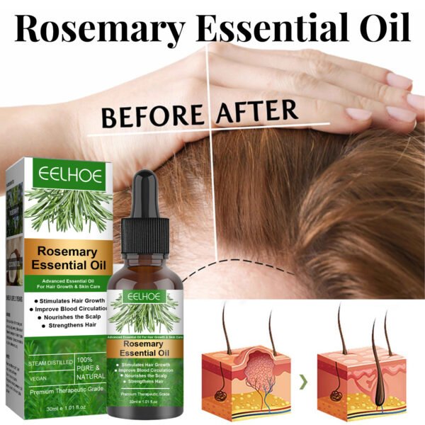 Rosemary Hair Oil Anti-loss Hair - Image 4